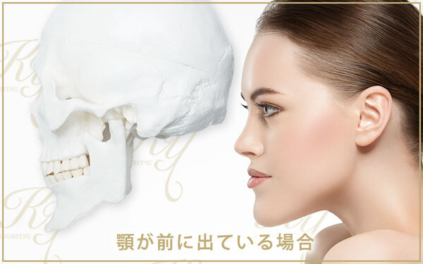 長い顎や曲がっている顎 引っ込んでいる顎の美容整形手術 共立美容外科
