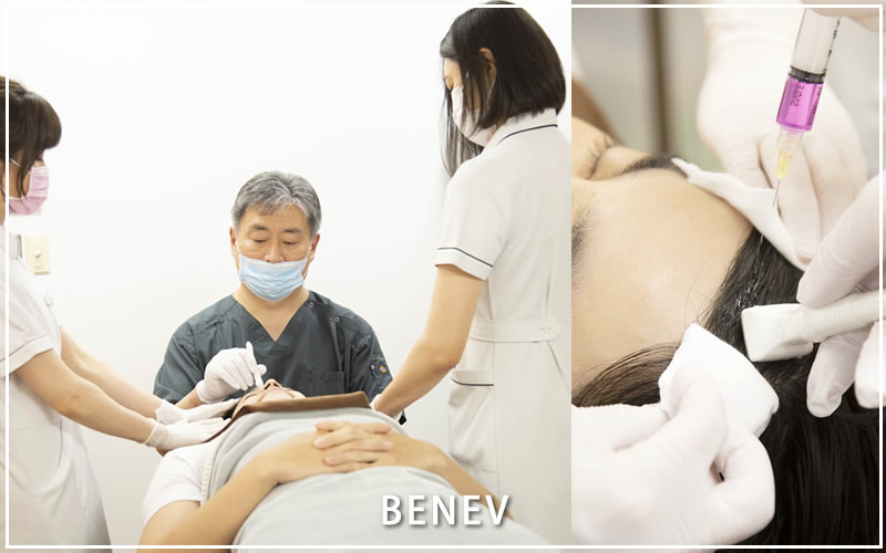 ベネブ社製の成長因子を使用したAGA治療 | 美容整形の【共立美容外科】