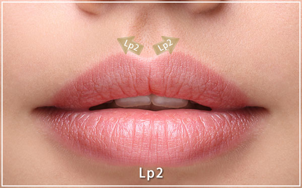 ボルベラ Volbella 共立美容外科