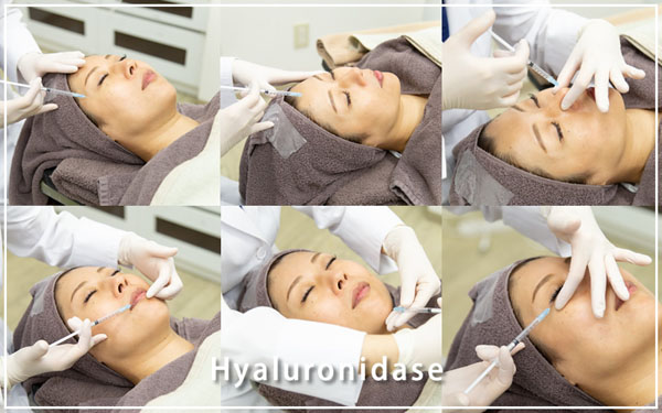 ヒアルロン酸の修正 ヒアルロニダーゼ 効果や方法について 共立美容外科